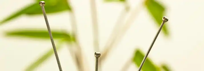 Acupuncture For Acid Reflux and GERD | Nutrition & Alternative Health