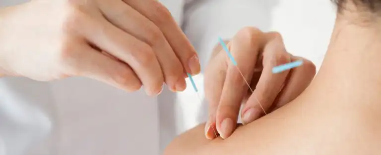 Acupuncture For Anxiety