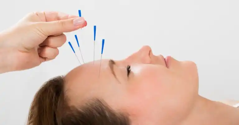 Acupuncture For Migraines and Ocular Inflammatory Diseases