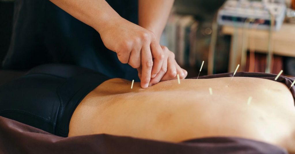 Choosing an acupuncturist in Belmont, MA, based on professional qualifications, individualized treatment approaches, and patient-focused care.